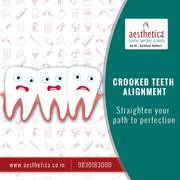 Crooked Teeth Alignment
