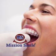 Achieve a Perfect Smile with Invisalign Braces in Kolkata from Mission